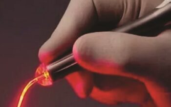 Moderné riešenie hemoroidov pomocou LHP metódy